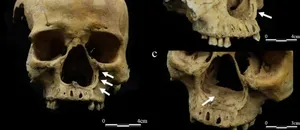 2 Bin Yıllık İskelet Antik Çin Hukukunun Karanlık Yüzünü Gösterdi