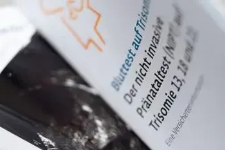 Bundestag Will Trisomie-Test Besser Überwachen