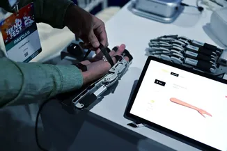 Yerli üretim robotik el rehabilitasyon sistemiyle hastalara düşük maliyetli tedavi amaçlanıyor